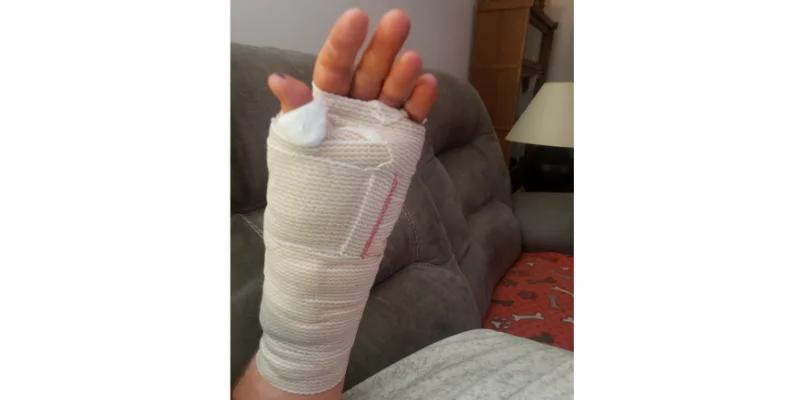 Hand surgery will put me on the 'DL' for a while — what it means for 11thFrame.com